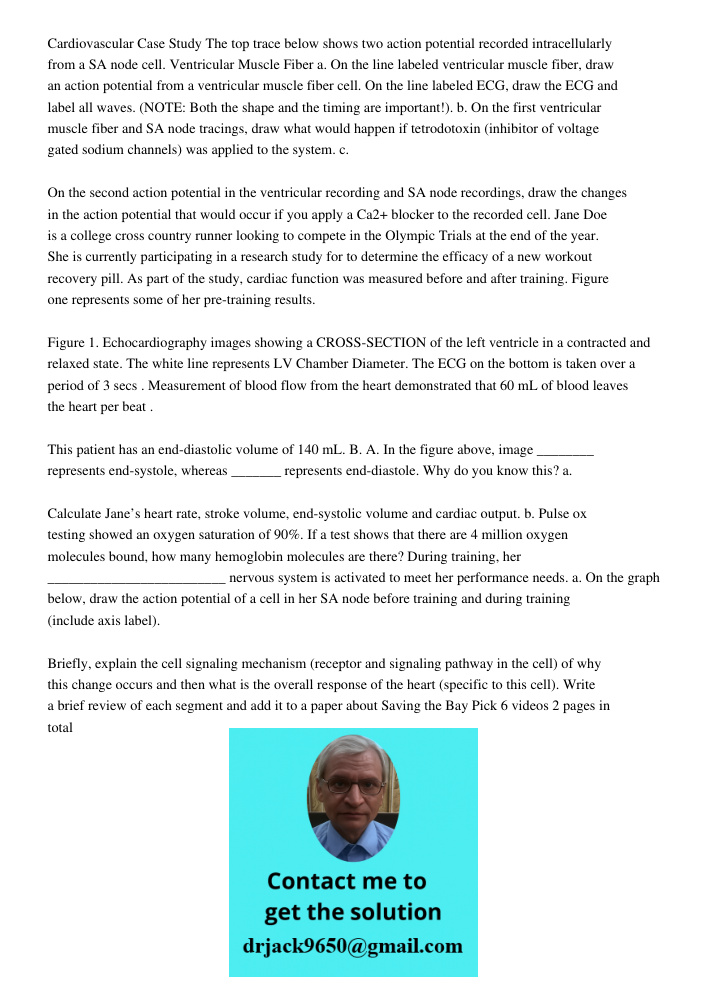 Cardiovascular Case Study The top trace below shows two action potential recorded intracellularly from a SA node cell. Ventricular Muscle Fiber a. On the line labeled ventricular muscle fiber, draw an action potential fr
